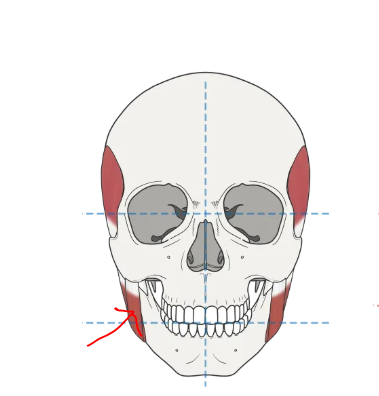 치아 교정 땅콩형 얼굴 되실까 걱정하고 계신다면? 관련 이미지 3