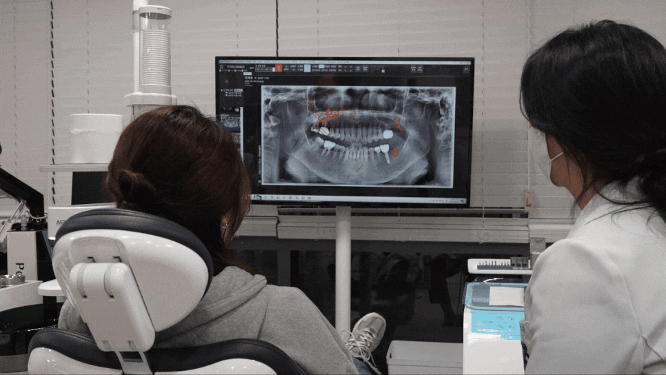 소아 악궁확장 RPE장치란? 성장기 1차 교정 진행해야할 때 관련 이미지 1