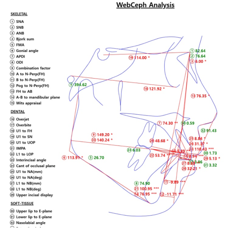 강동구 치아교정 아이들 방학 때 시작하면 좋은 이유 관련 이미지 4
