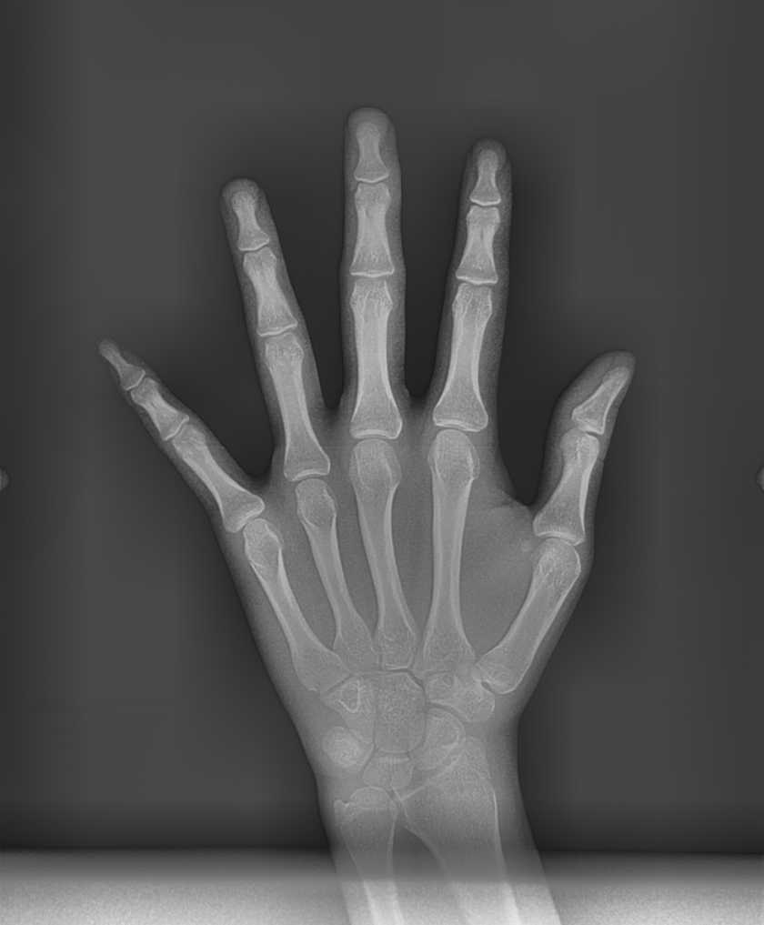 교정은 어릴 때 해야 한다? 성인과 청소년 교정, 뭐가 다를까? 관련 이미지 2