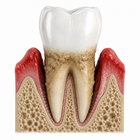 My Tooth Was Loose, Then It Fell Out at Home... image 7