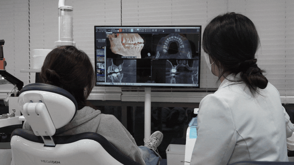 이 뽑고 바로 임플란트 심어도 될까요?? 관련 이미지 1