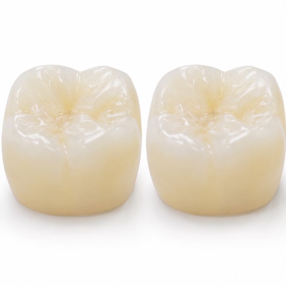 Tooth-Colored Dental Crown Types: PFM and Zirconia (Ziconia) image 6