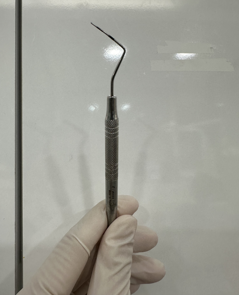 잇몸 주저앉음 발치하게 되는 제일 큰 원인이기에 잇몸치료 과정 공개 관련 이미지 6