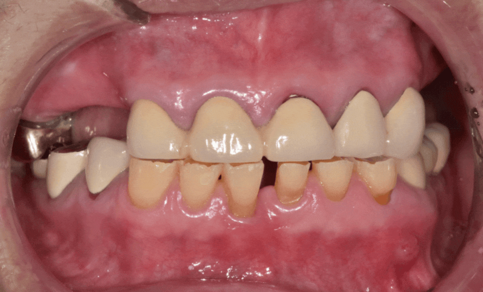 합죽이입 처럼 보이는 이유, 낮아진 관련 이미지 13