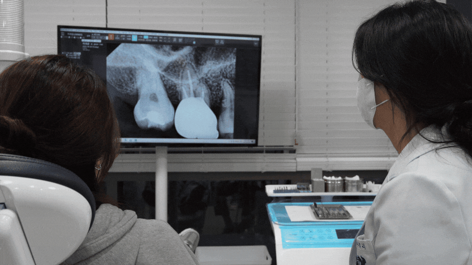 벌어진 앞니 치아 교정 통해 공간 닫기 장점이 많습니다. 관련 이미지 1