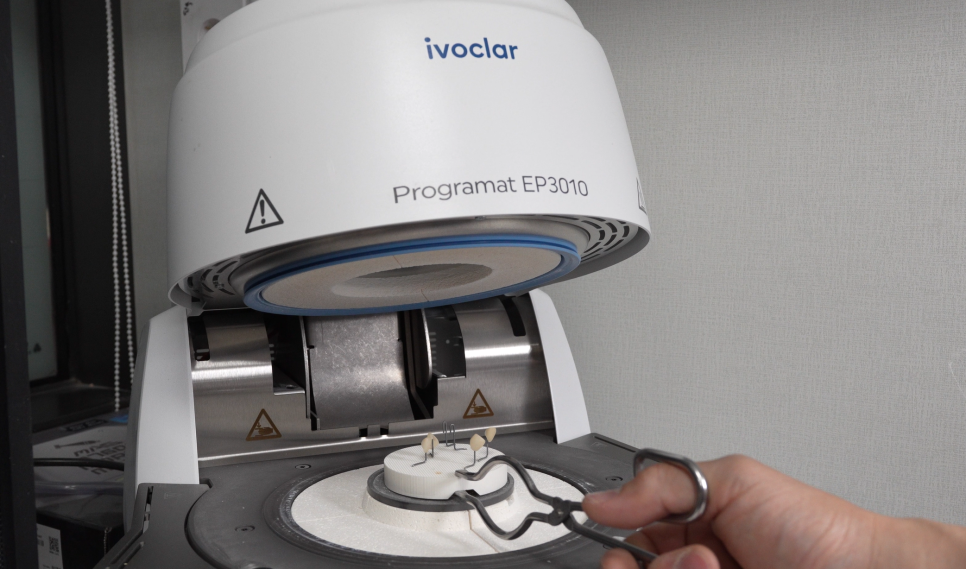 치아 사이 충치 원데이 인레이 하루만에 끝낼 수가 있을까? 관련 이미지 3