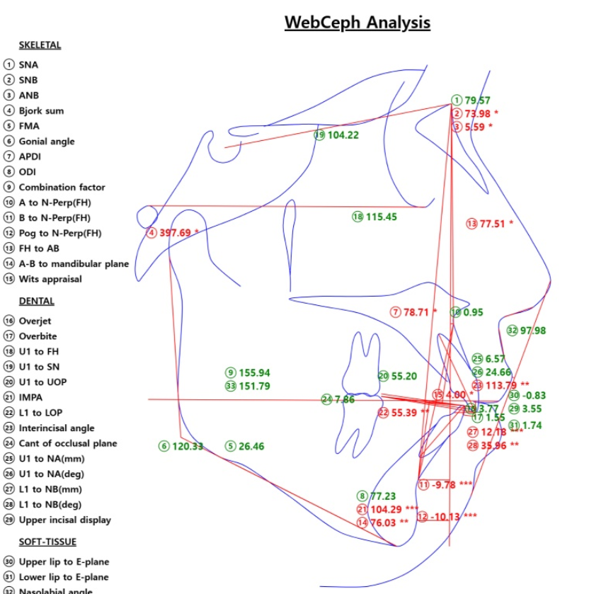 상일동 치아 교정 고려해봐야할 2가지 요소 관련 이미지 4
