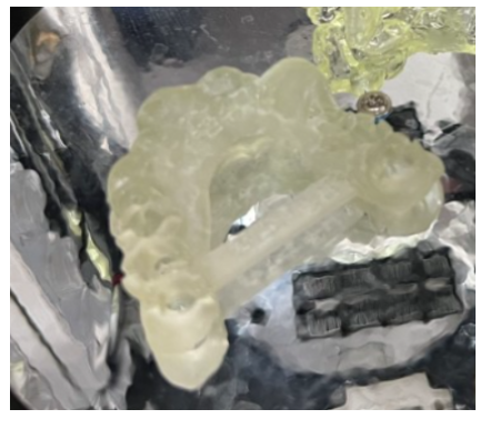 하남시청치과 내비게이션 임플란트 왜 좋다는거죠? 관련 이미지 5