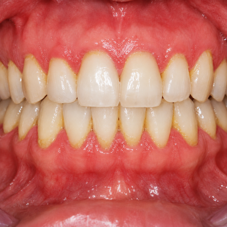 My Tooth Was Loose, Then It Fell Out at Home... image 4