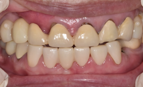 합죽이입 처럼 보이는 이유, 낮아진 관련 이미지 8