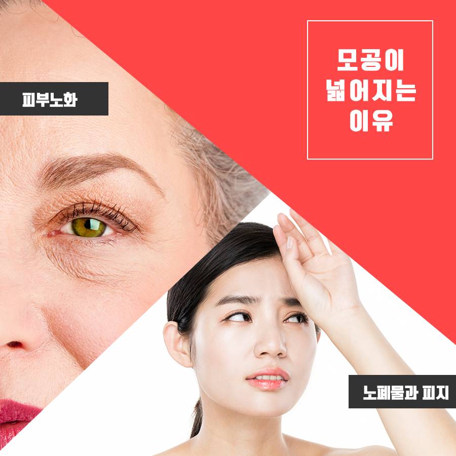 피부모공축소 매끈한 얼굴 만들기 관련 이미지 2