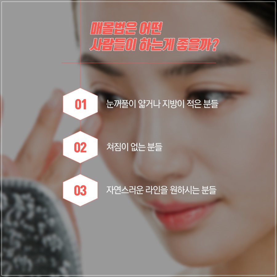 신도림 성형외과 나에게 맞는 눈성형 알려드려요! 관련 이미지 6