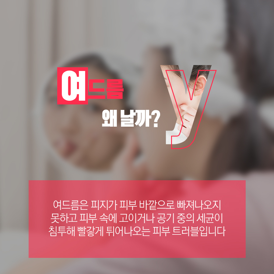여드름을 줄이는 식습관 관련 이미지 3