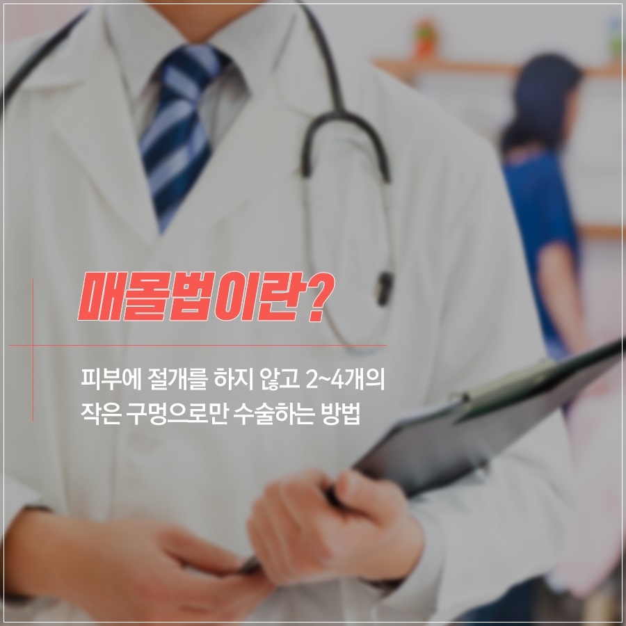 신도림 성형외과 나에게 맞는 눈성형 알려드려요! 관련 이미지 4