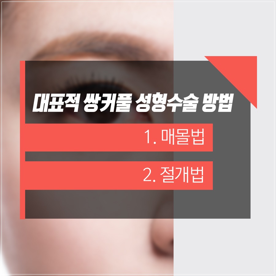 신도림 성형외과 나에게 맞는 눈성형 알려드려요! 관련 이미지 3