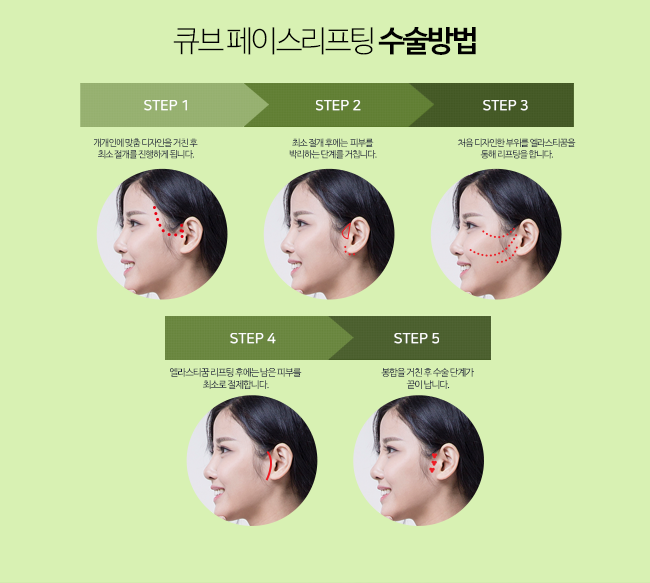 큐브 페이스리프팅 관련 이미지 3