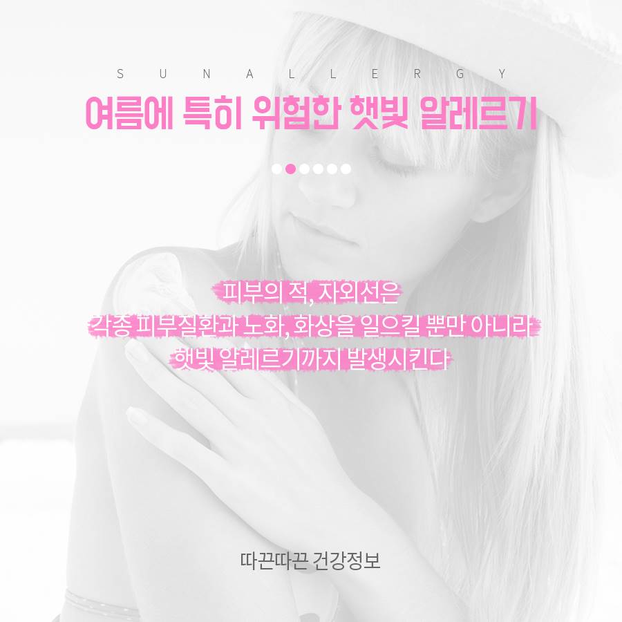 햇빛 알레르기 제대로 예방해요 관련 이미지 3