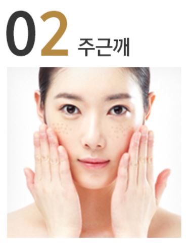 기미와 주근깨에 대한 상식 관련 이미지 3