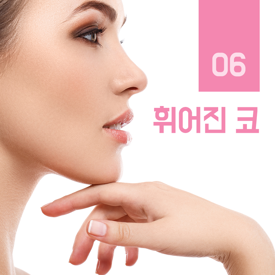 유형별 코 내 코는 어떤 모양일까? 관련 이미지 8