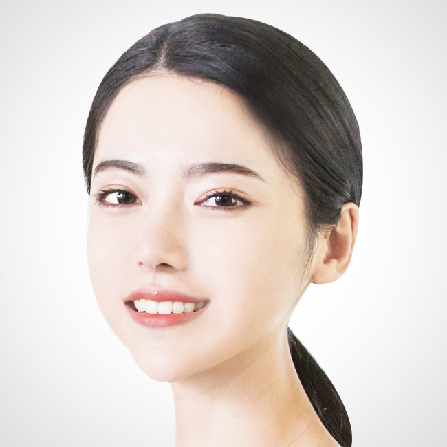 큐브 페이스리프팅 관련 이미지 5