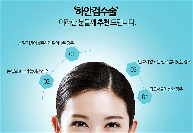 하안검수술 잘하는곳 큐브성형외과 관련 이미지 5