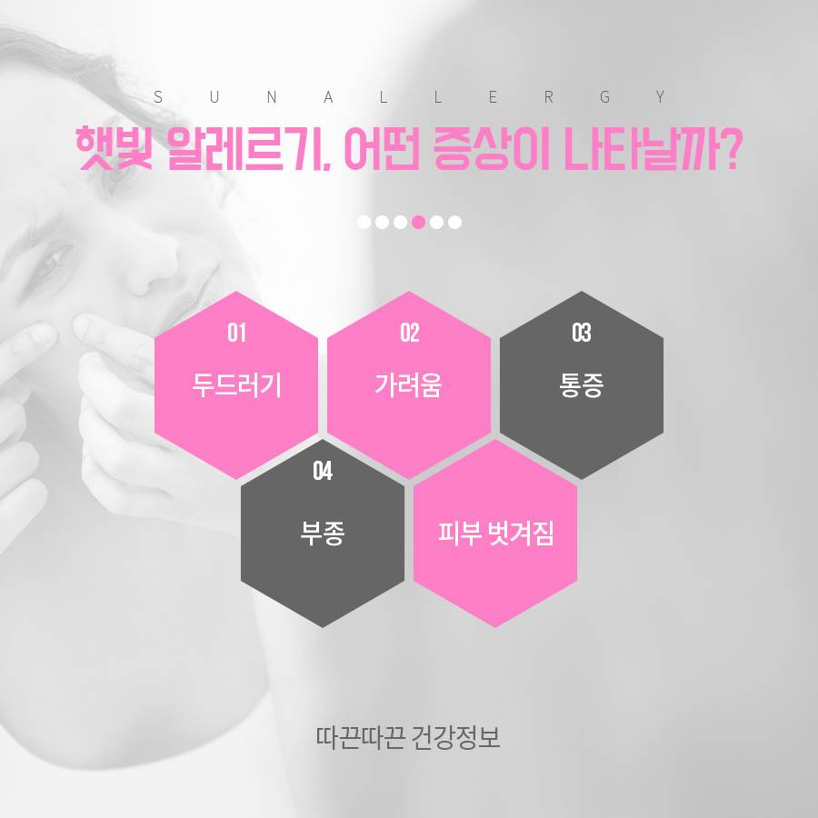 햇빛 알레르기 증상, 나도 혹시? 관련 이미지 2