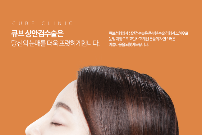 큐브 상안검수술 관련 이미지 2