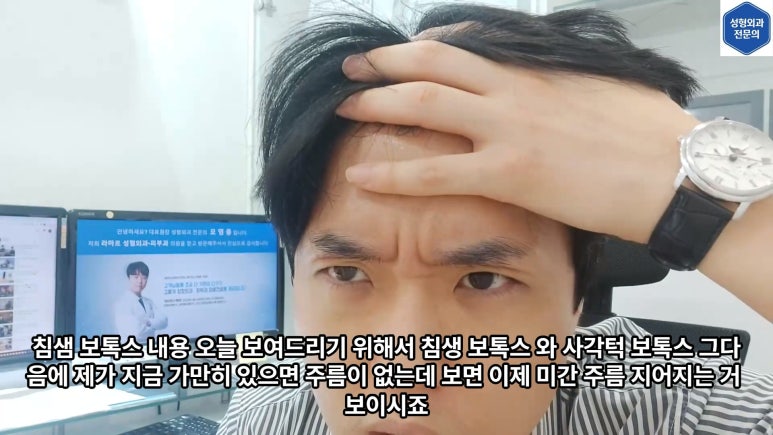 모영웅 대표원장 셀프시술 제6편! 사각턱, 침샘, 미간, 자갈턱 보톡스~! 전체 시술과정 공개합니다 관련 이미지 6
