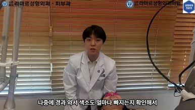 21세 여성 코 지름 1cm 점 제거수술 : 나선피판술(Spiral Flap) 수술전~5달 경과. (+쌍꺼풀수술, 코필러) 관련 이미지 48