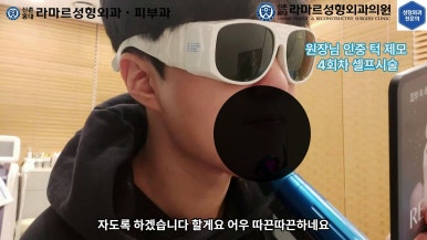 [성형외과 전문의의 셀프시술 제8편] 인중, 아래턱 제모 4회차 결과 공개! 관련 이미지 104