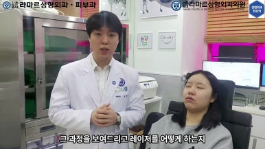 21세 여성 코 지름 1cm 점 제거수술 : 나선피판술(Spiral Flap) 수술전~5달 경과. (+쌍꺼풀수술, 코필러) 관련 이미지 15