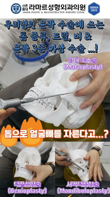 성형수술의 끝판! 성형외과 윤곽수술을 알려드립니다. 저희병원에서 사용하는 수술기구, 그리고 윤곽3종 모의수술....!! 관련 이미지 5