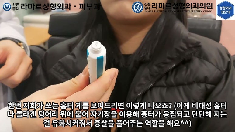 지름 1cm 코 점 제거수술 : 나선피판술(Spiral Flap) 수술전~1달 경과. (Feat. 턱끝필러+사각턱 보톡스) 관련 이미지 175