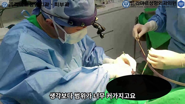 파라핀 필러 입 안 절개로 흉터없이 빼내기! 관련 이미지 27