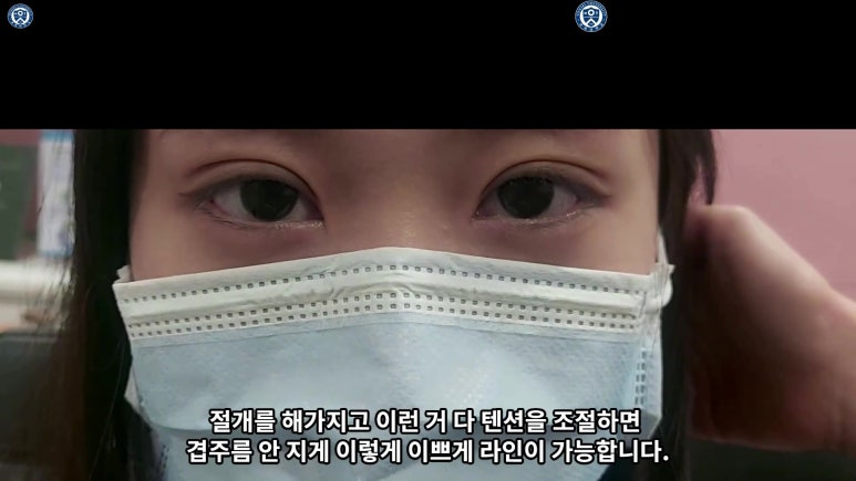 매몰 쌍꺼풀 풀고 절개쌍꺼풀로 바꾸는 쌍꺼풀 재수술!! 관련 이미지 71