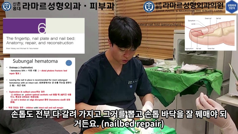 손가락 힘줄 손상 및 열상, 손톱 바닥 열상 처치 (Extensor tendon repair and nailbed injury treatment) 관련 이미지 11