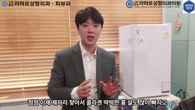 21세 여성 코 지름 1cm 점 제거수술 : 나선피판술(Spiral Flap) 수술전~5달 경과. (+쌍꺼풀수술, 코필러) 관련 이미지 74