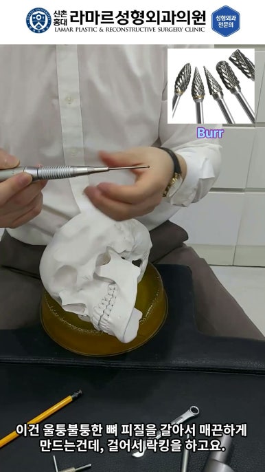 성형수술의 끝판! 성형외과 윤곽수술을 알려드립니다. 저희병원에서 사용하는 수술기구, 그리고 윤곽3종 모의수술....!! 관련 이미지 62