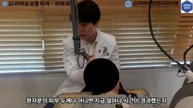 21세 여성 코 지름 1cm 점 제거수술 : 나선피판술(Spiral Flap) 수술전~5달 경과. (+쌍꺼풀수술, 코필러) 관련 이미지 45