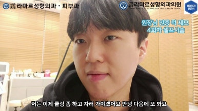 [성형외과 전문의의 셀프시술 제8편] 인중, 아래턱 제모 4회차 결과 공개! 관련 이미지 165
