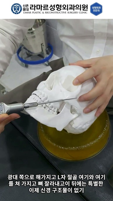 성형수술의 끝판! 성형외과 윤곽수술을 알려드립니다. 저희병원에서 사용하는 수술기구, 그리고 윤곽3종 모의수술....!! 관련 이미지 48