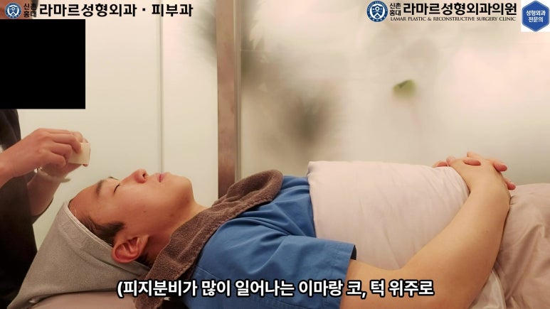 저의 코 모공, 블랙헤드 관리 실제 영상 및 후기~! 관련 이미지 39