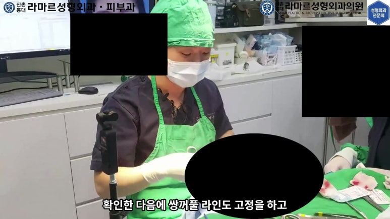 매몰 쌍꺼풀 풀고 절개쌍꺼풀로 바꾸는 쌍꺼풀 재수술!! 관련 이미지 24