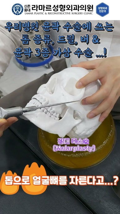 성형수술의 끝판! 성형외과 윤곽수술을 알려드립니다. 저희병원에서 사용하는 수술기구, 그리고 윤곽3종 모의수술....!! 관련 이미지 6