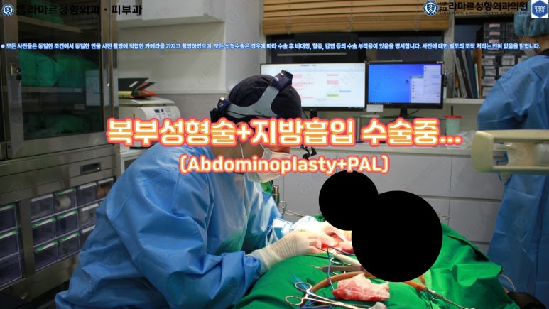 '복부성형술+지방흡입(Abdominoplasty+PAL)' 으로 뱃살 끝장내기! 관련 이미지 38