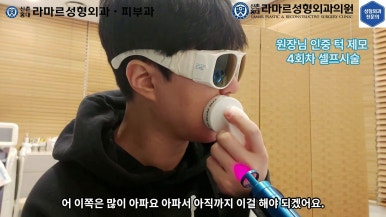 [성형외과 전문의의 셀프시술 제8편] 인중, 아래턱 제모 4회차 결과 공개! 관련 이미지 109