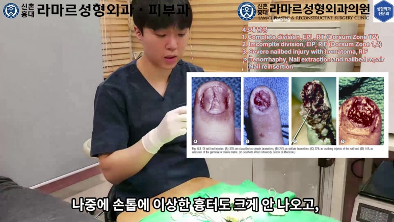 손가락 힘줄 손상 및 열상, 손톱 바닥 열상 처치 (Extensor tendon repair and nailbed injury treatment) 관련 이미지 23