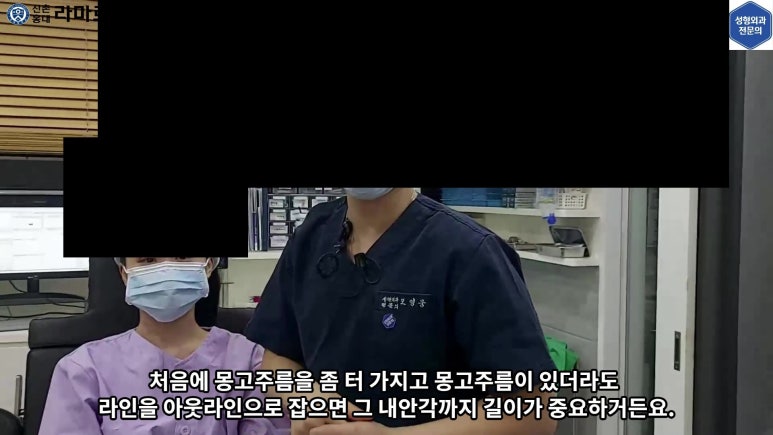 매몰 쌍꺼풀 풀고 절개쌍꺼풀로 바꾸는 쌍꺼풀 재수술!! 관련 이미지 48