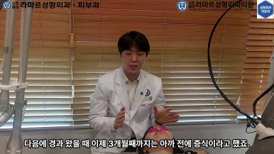 21세 여성 코 지름 1cm 점 제거수술 : 나선피판술(Spiral Flap) 수술전~5달 경과. (+쌍꺼풀수술, 코필러) 관련 이미지 50